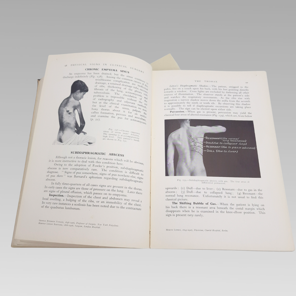 1940 Hamilton Bailey Physical Signs in Clinical Surgery 7th Ed